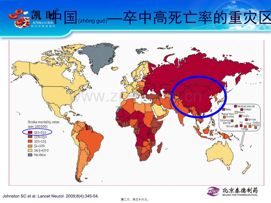 学术讨论—缺血性卒中及微循环.ppt_第2页