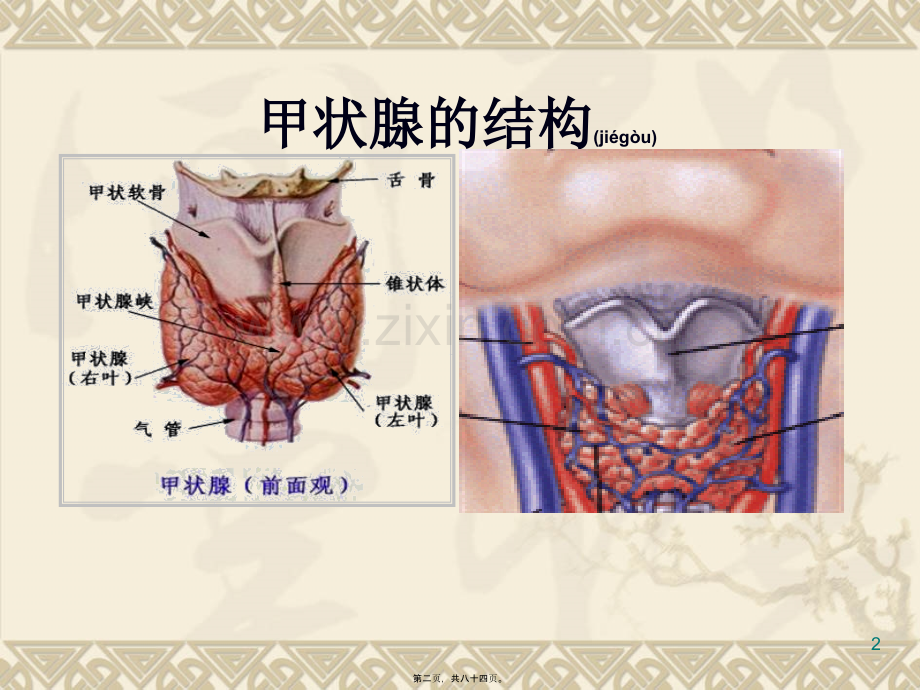 第四节甲状腺功能亢进症(已改)李秋平.ppt_第2页