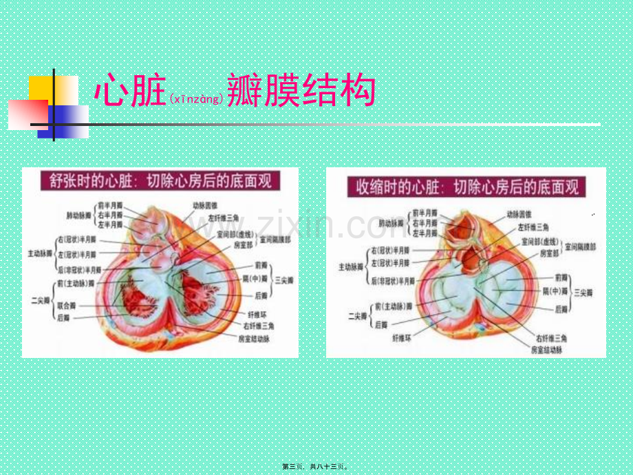 学术讨论—第三篇-第八章-心脏瓣膜病-好.ppt_第3页