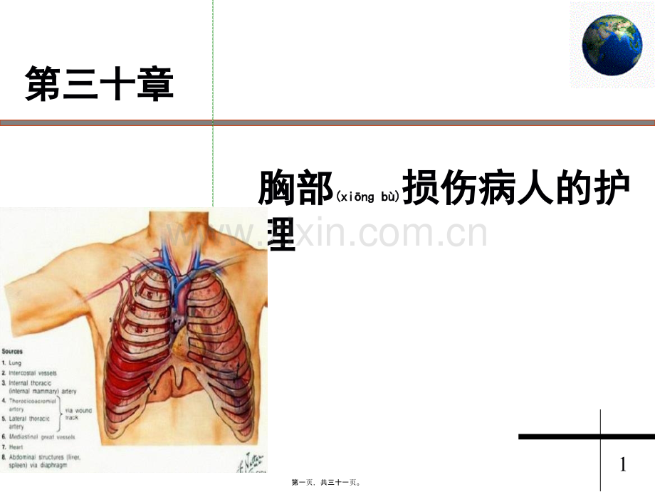 第三十章胸部损伤病人.ppt_第1页