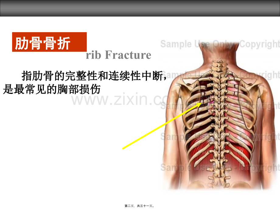 第三十章胸部损伤病人.ppt_第2页