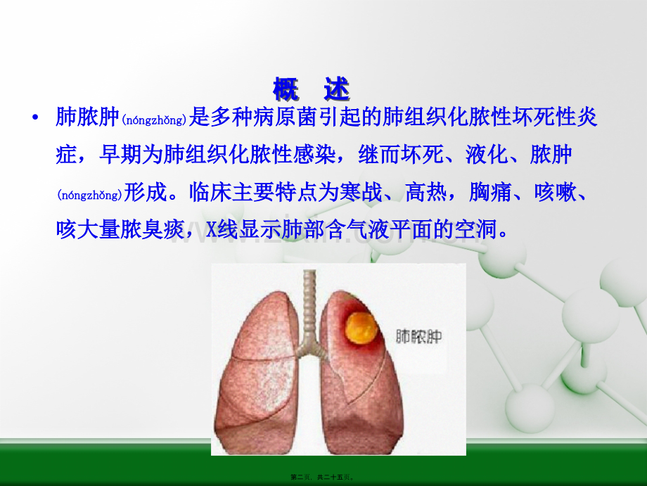 第四节---肺脓肿.ppt_第2页