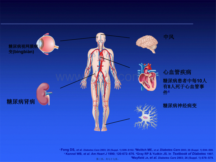 糖尿病基本用药(1).ppt_第3页