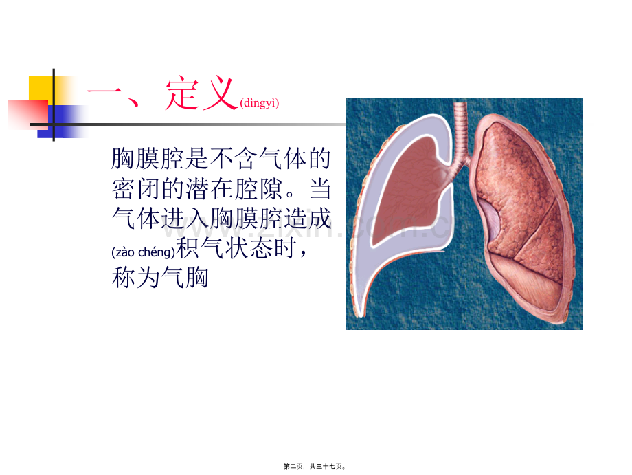 学术讨论—第十一章-第三节-气胸.ppt_第2页