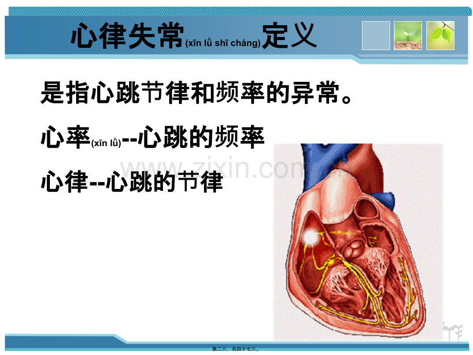 学术讨论—第二十章抗心律失常药分解.ppt_第2页