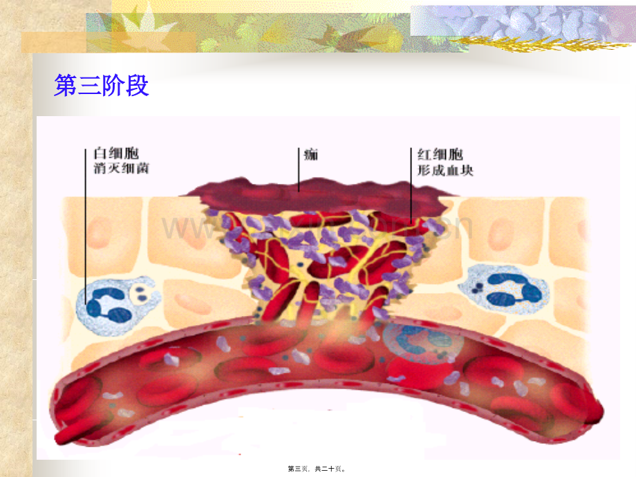 学术讨论—第三篇.血液(2).ppt_第3页