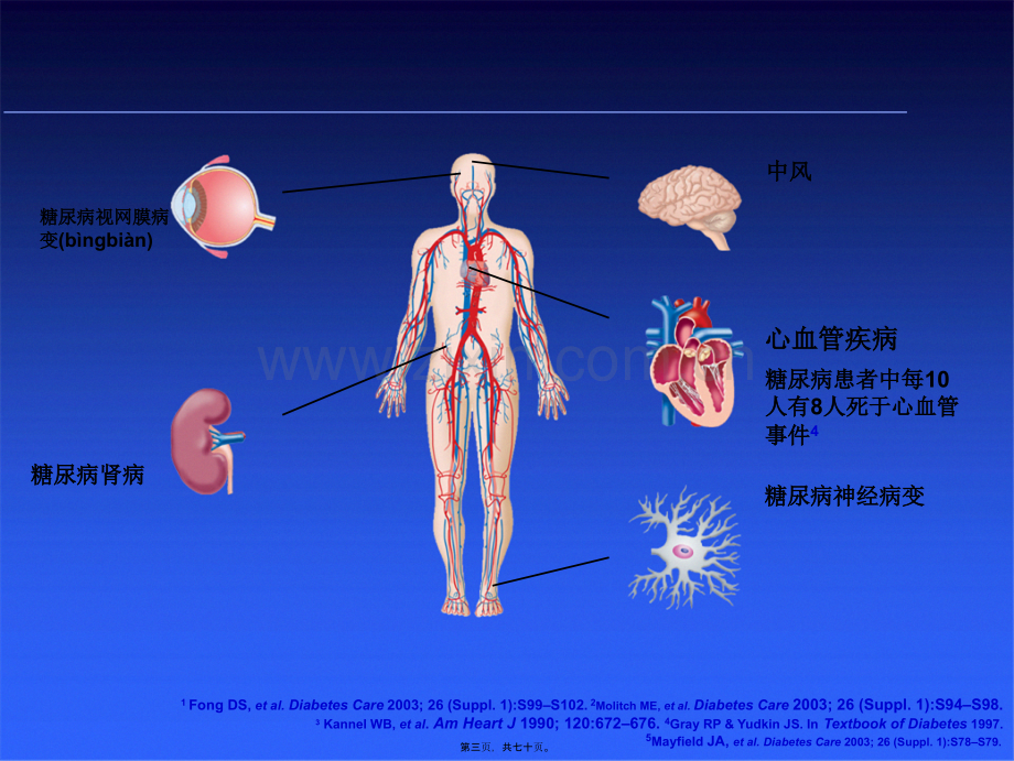 糖尿病基本用药.ppt_第3页