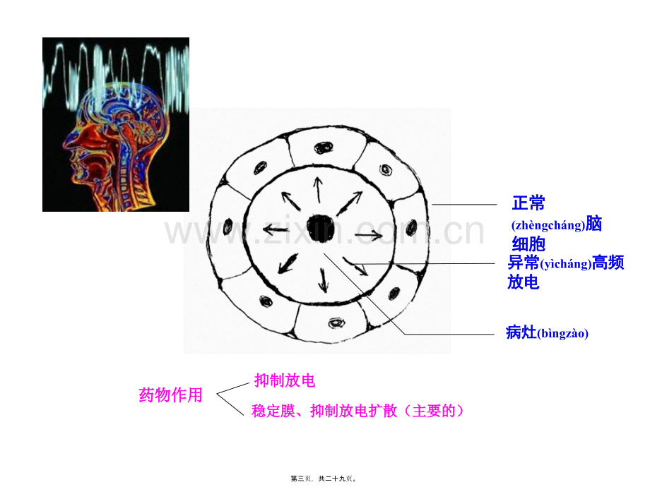 第十七章-抗癫痫药与抗惊厥药.ppt_第3页