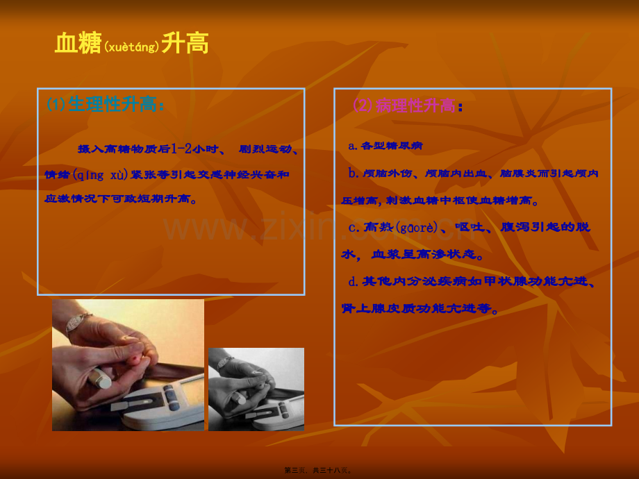 糖尿病监测及意义全解.ppt_第3页