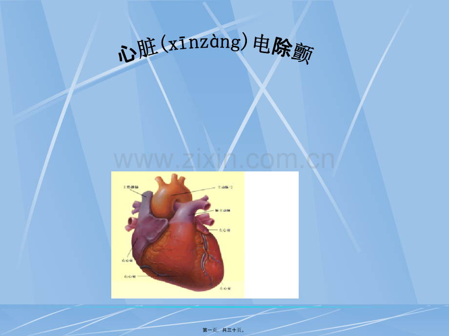 学术讨论—罗柳青-心脏电除颤术.ppt_第1页