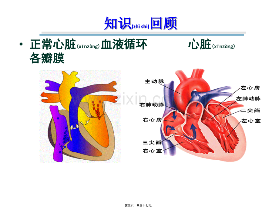 学术讨论—第三章-第6节-心脏瓣膜病讲述.ppt_第3页