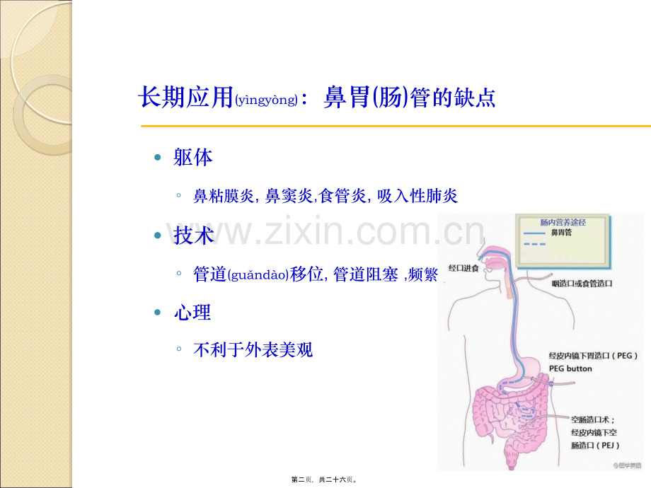 经皮内窥镜引导下胃造口管.ppt_第2页