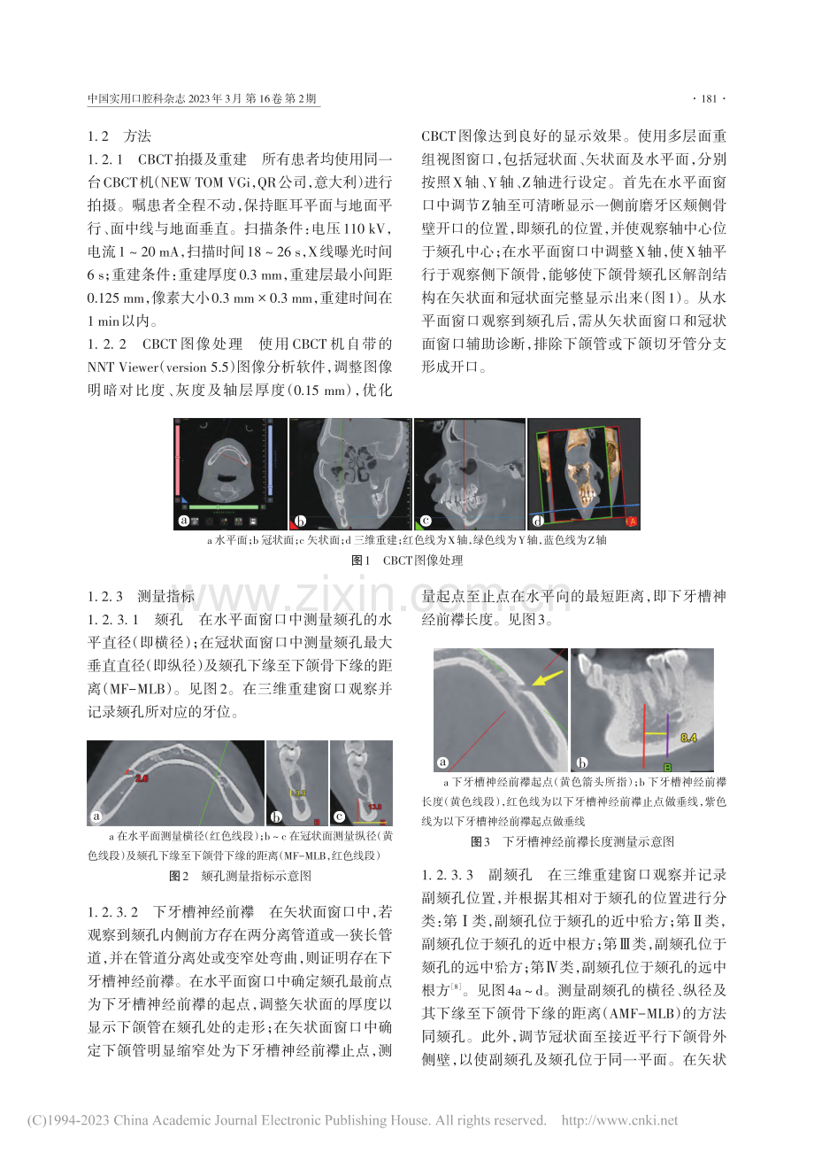 基于锥形束CT的颏孔区解剖结构分析_许哲欣.pdf_第3页