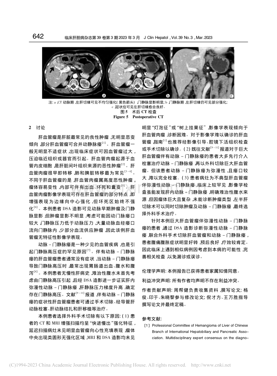 巨大肝血管瘤伴弥漫性动脉-门静脉瘘1例报告_周帮健.pdf_第3页