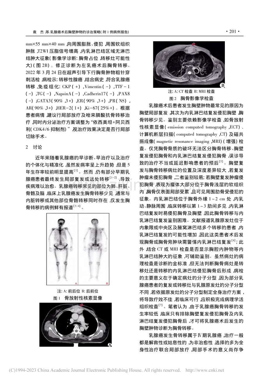 乳腺癌术后胸壁肿物的诊治策略(附1例病例报告)_袁杰.pdf_第2页