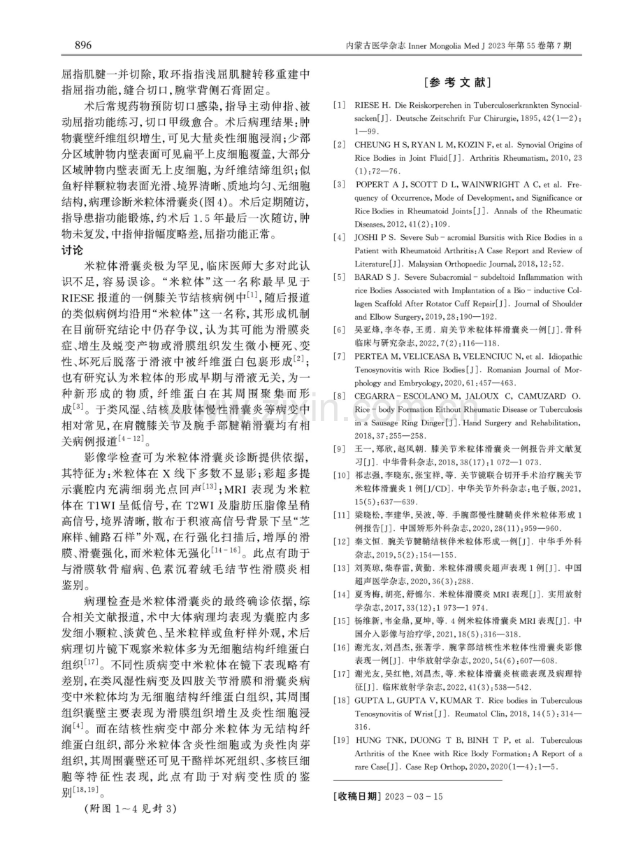 手屈指肌腱腱鞘米粒体滑囊炎一例报告.pdf_第2页