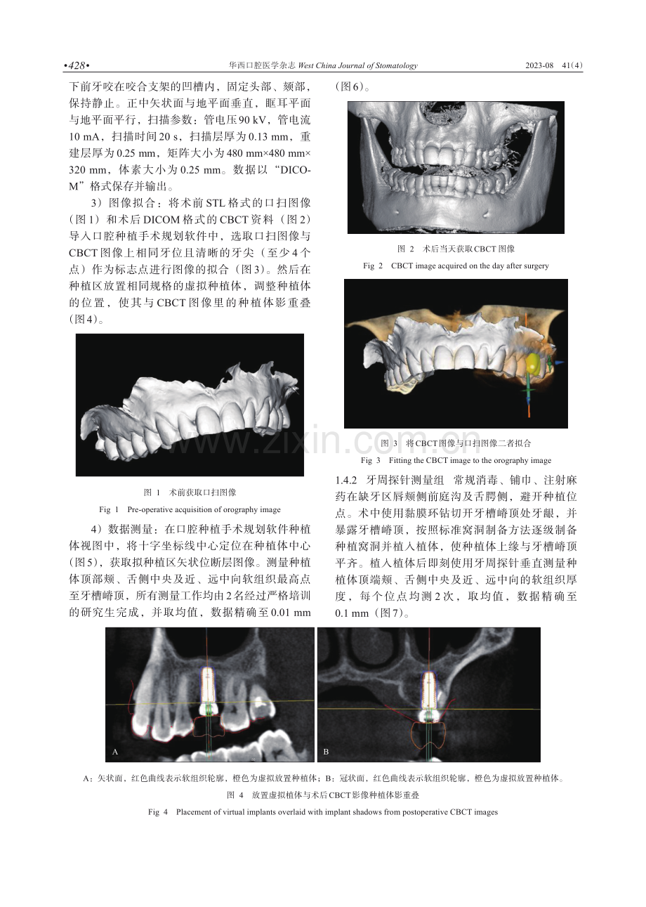 数字化方法测量种植体周围骨嵴上软组织高度可行性分析.pdf_第3页