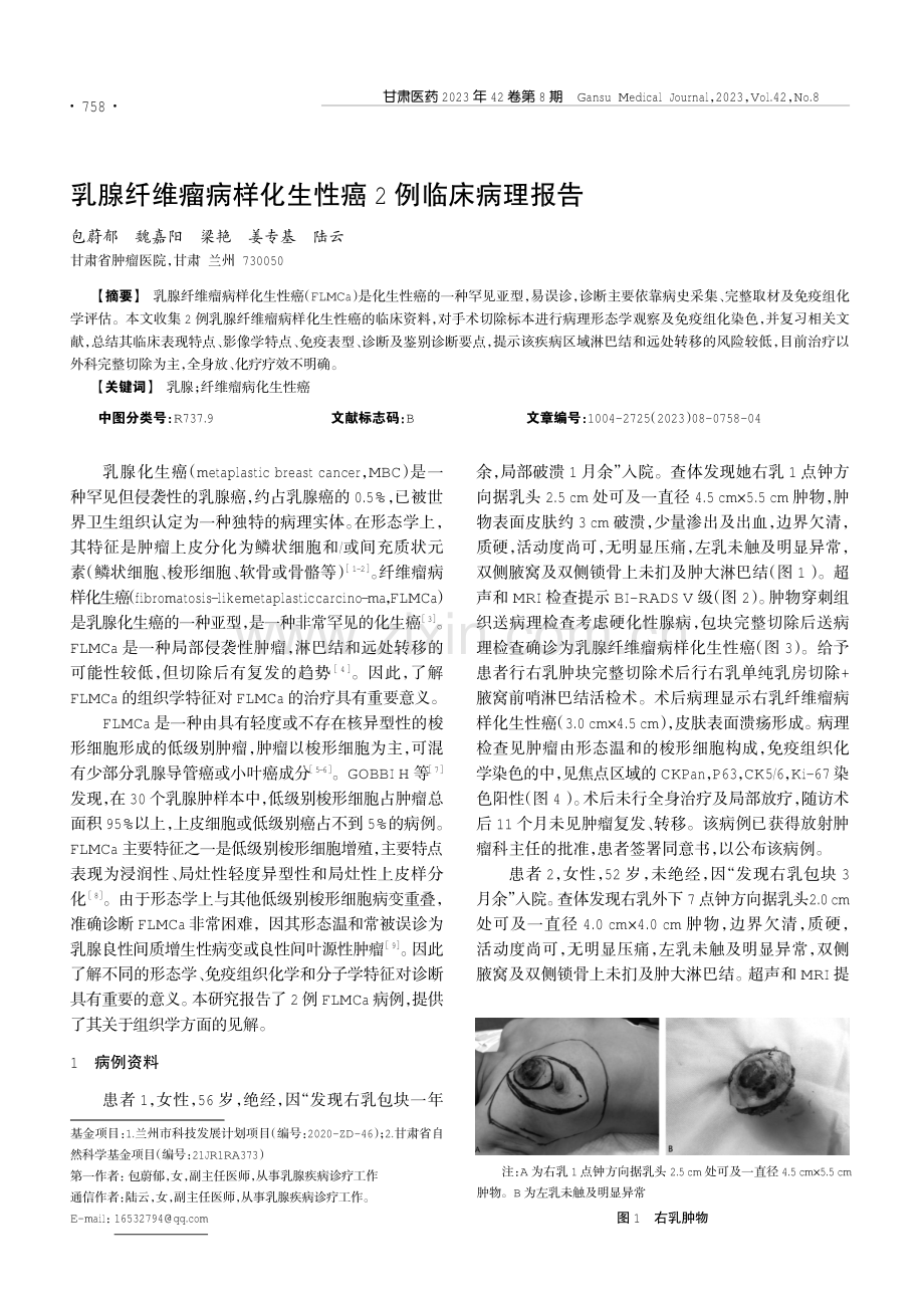 乳腺纤维瘤病样化生性癌2例临床病理报告.pdf_第1页