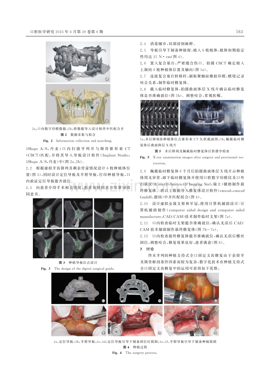 数字化技术在种植支持式全口固定义齿修复中的运用1例_贺志肖.pdf_第2页