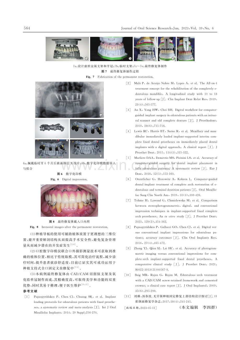 数字化技术在种植支持式全口固定义齿修复中的运用1例_贺志肖.pdf_第3页