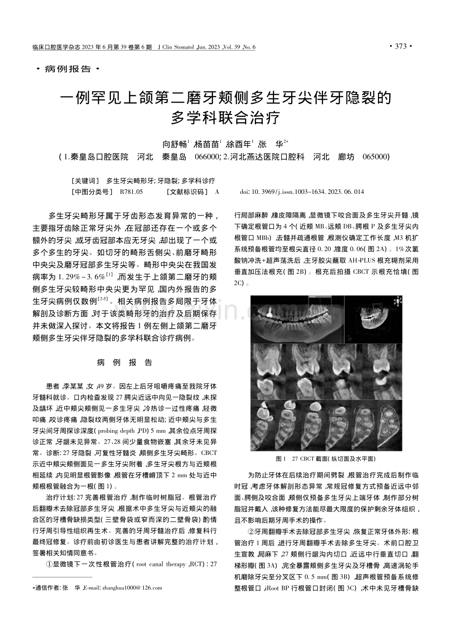 一例罕见上颌第二磨牙颊侧多...尖伴牙隐裂的多学科联合治疗_向舒畅.pdf_第1页