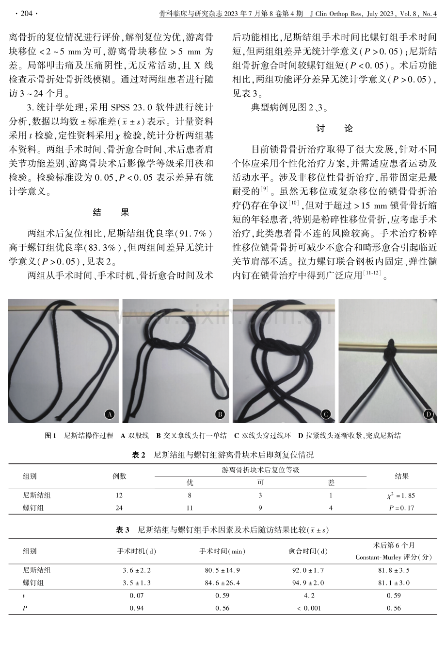 应用尼斯结辅助治疗锁骨骨折的临床疗效观察.pdf_第3页