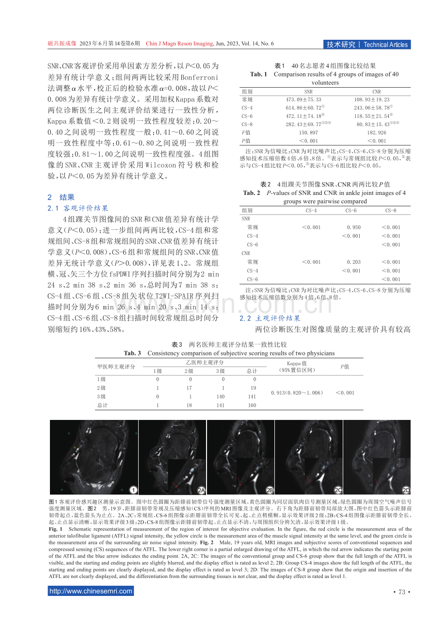 压缩感知技术三维MRI矢状位T2加权频率衰减反转恢复序列显示距腓前韧带的价值探索.pdf_第3页