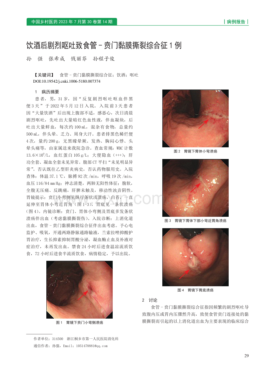 饮酒后剧烈呕吐致食管-贲门黏膜撕裂综合征1例_孙强.pdf_第1页