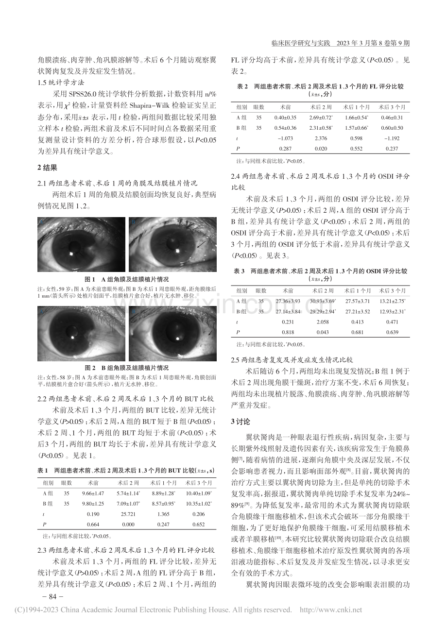 翼状胬肉切除联合改良结膜移...疗原发性翼状胬肉的效果比较_吕艳丽.pdf_第3页