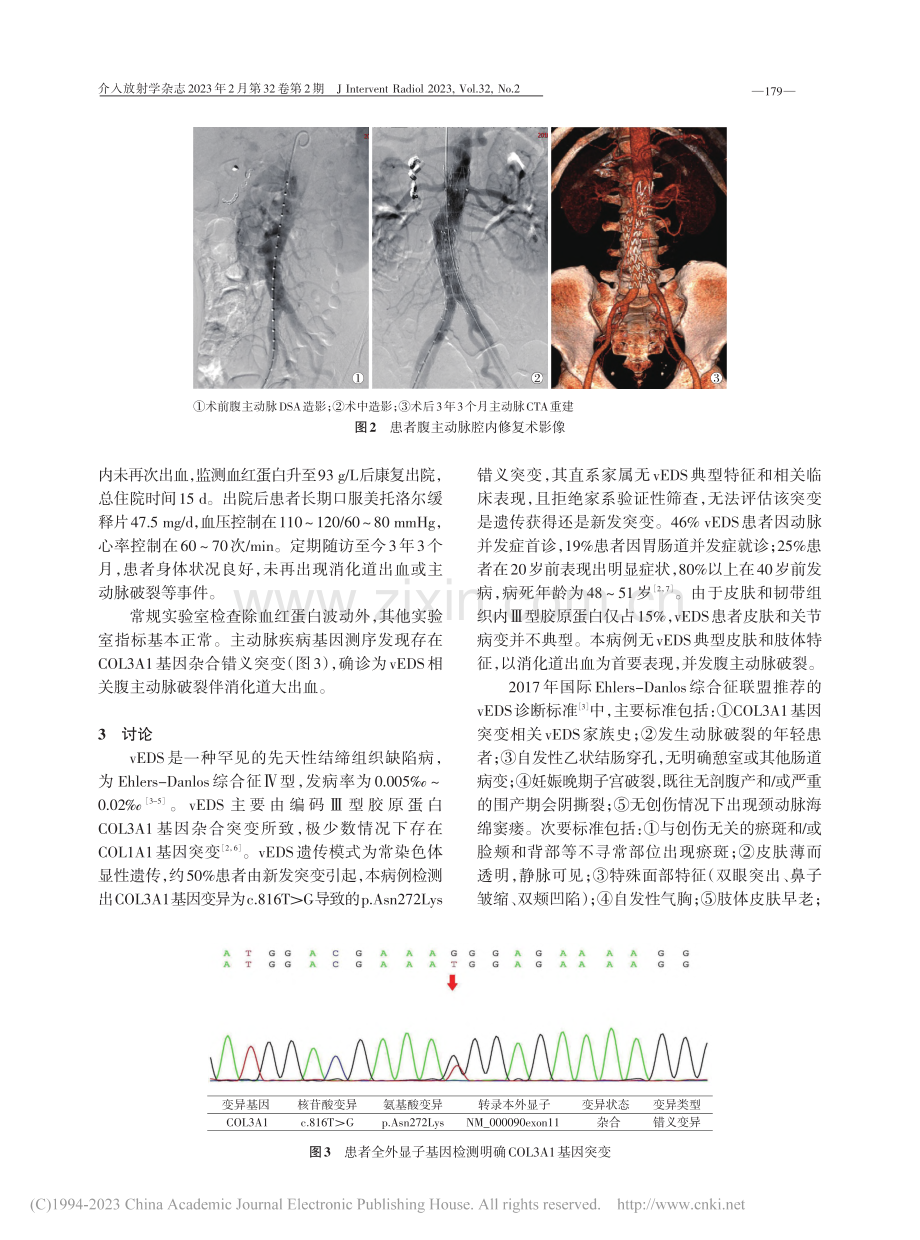 血管型Ehlers-Dan.消化道大出血1例并文献复习_李西山.pdf_第3页