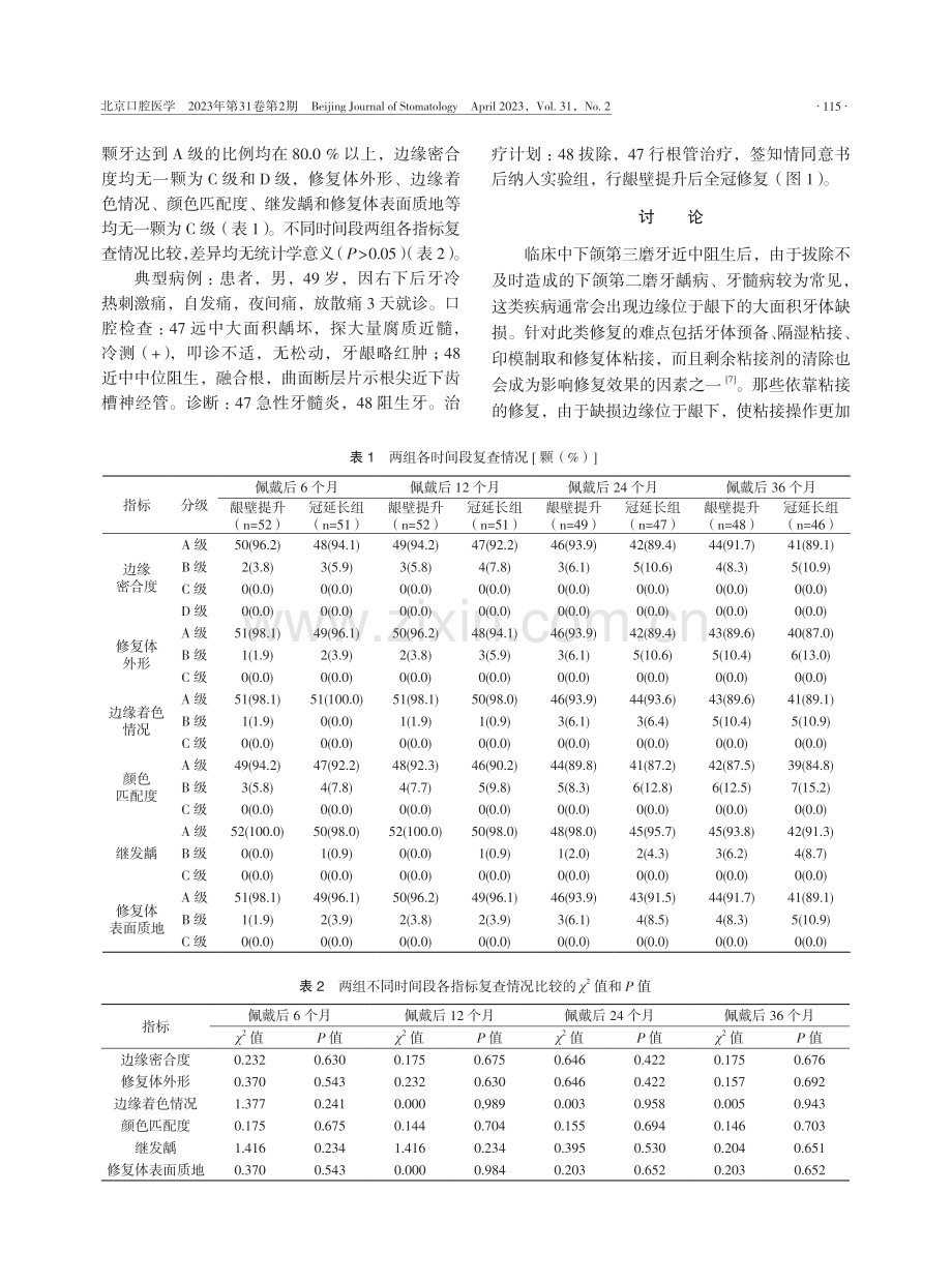 应用龈壁提升术修复下颌第二磨牙远中龈下缺损的临床效果.pdf_第3页