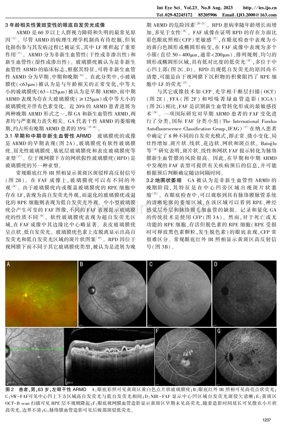 眼底自发荧光在年龄相关性黄斑变性中的应用指南（2023）pdf_第3页