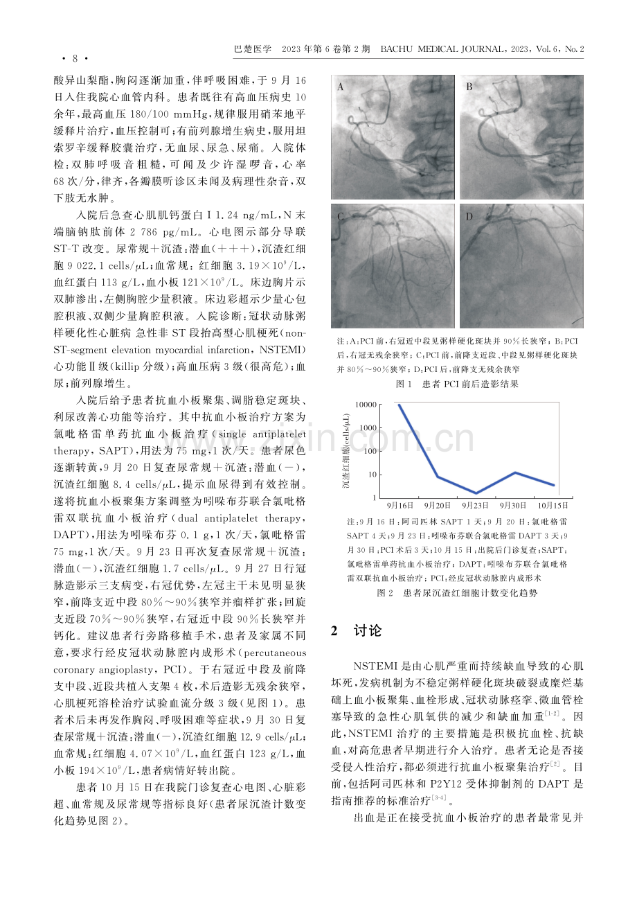 吲哚布芬联合氯吡格雷治疗急性非ST段抬高型心肌梗死合并血尿1例.pdf_第2页