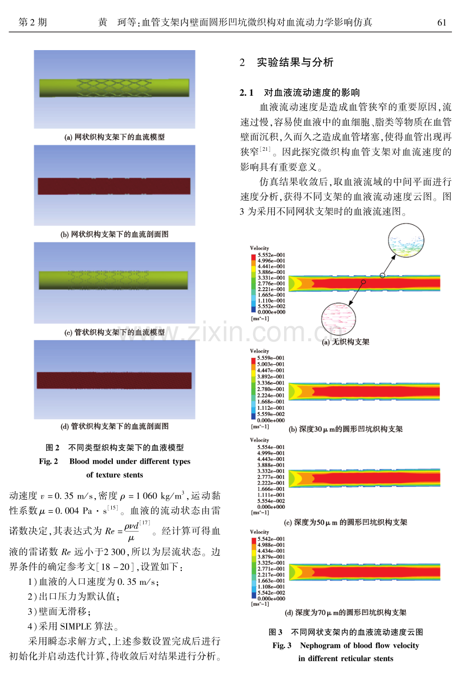 血管支架内壁面圆形凹坑微织构对血流动力学影响仿真.pdf_第3页