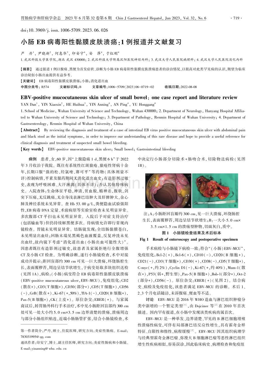 小肠EB病毒阳性黏膜皮肤溃疡：1例报道并文献复习_严丹.pdf_第1页