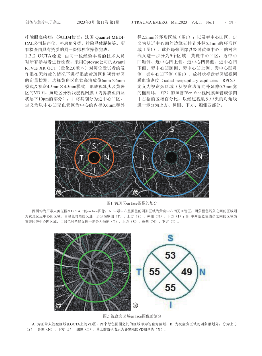 原发性急性闭角型青光眼急性发作期视网膜血管密度特征分析.pdf_第3页