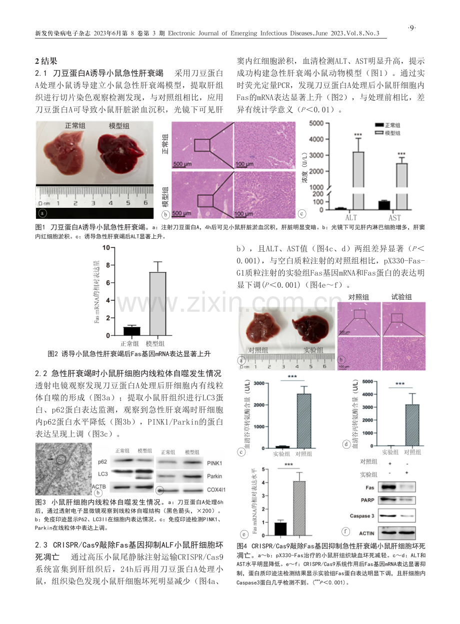 CRISPR_Cas9沉默Fas可抑制急性肝衰竭细胞线粒体自噬及减轻线粒体损伤.pdf_第3页