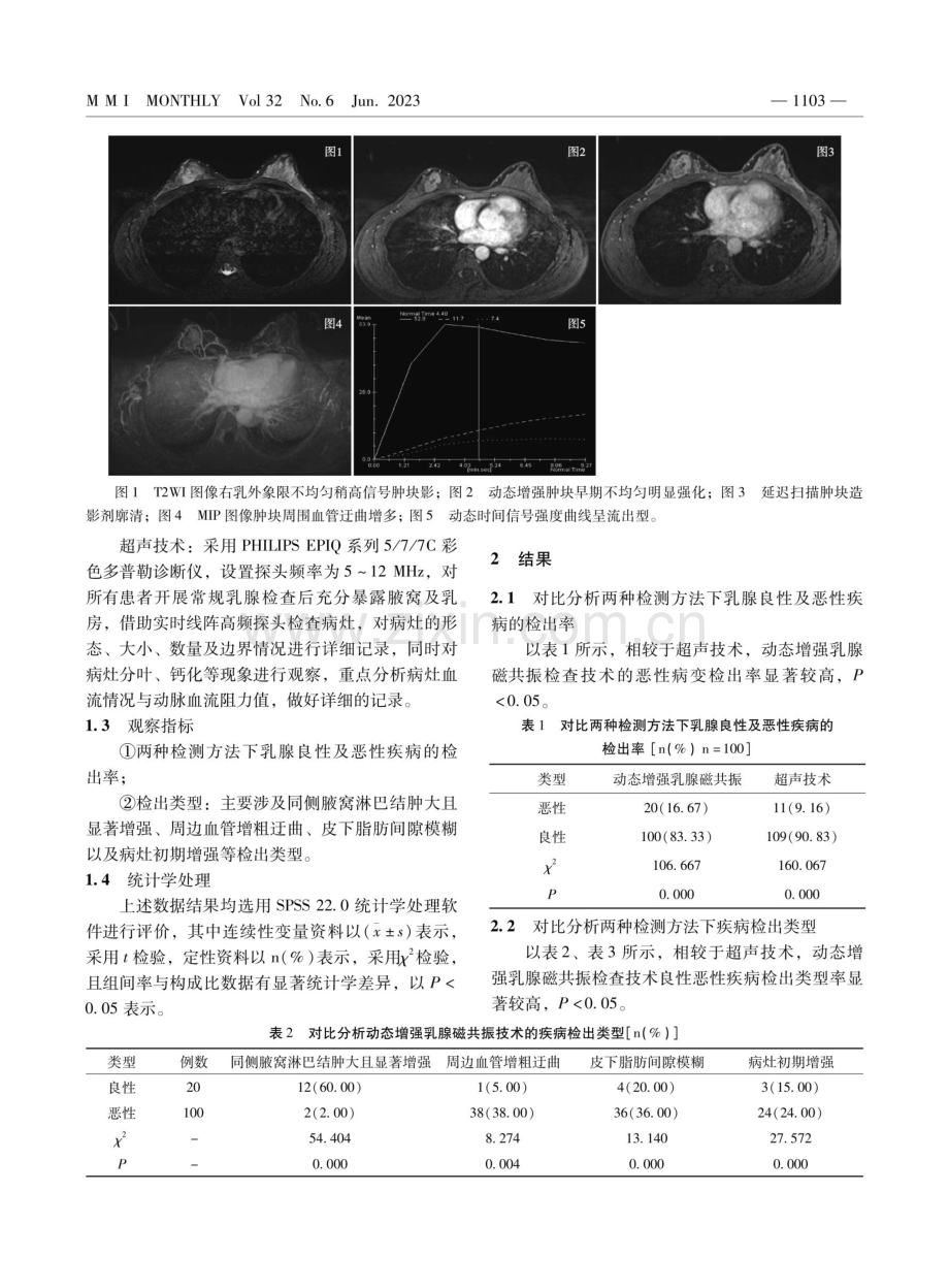 磁共振动态增强检查技术在乳腺疾病诊断中的效果及检出率评价.pdf_第2页