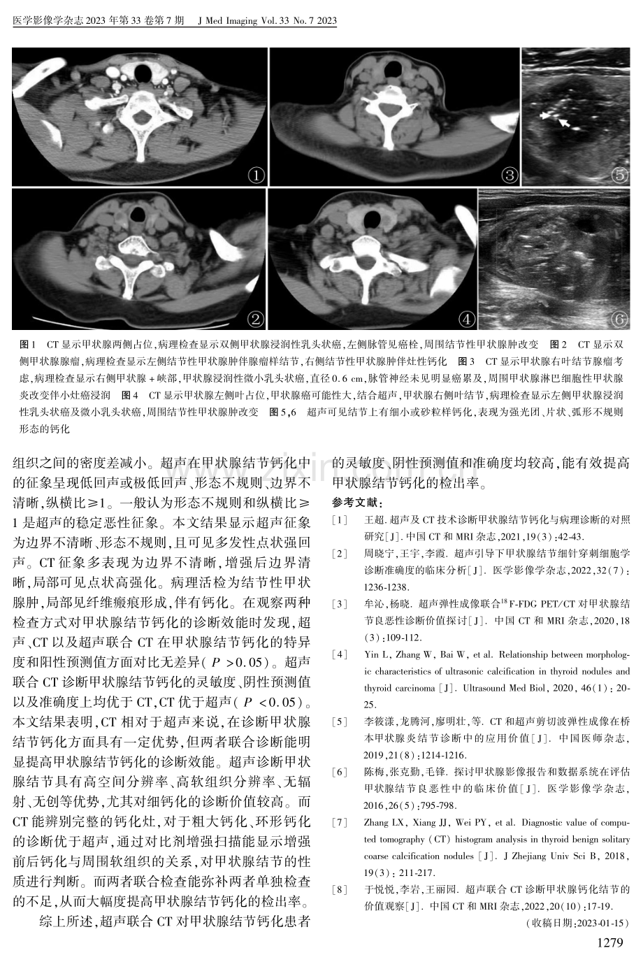 多层螺旋CT联合超声诊断甲状腺钙化结节的临床价值.pdf_第3页