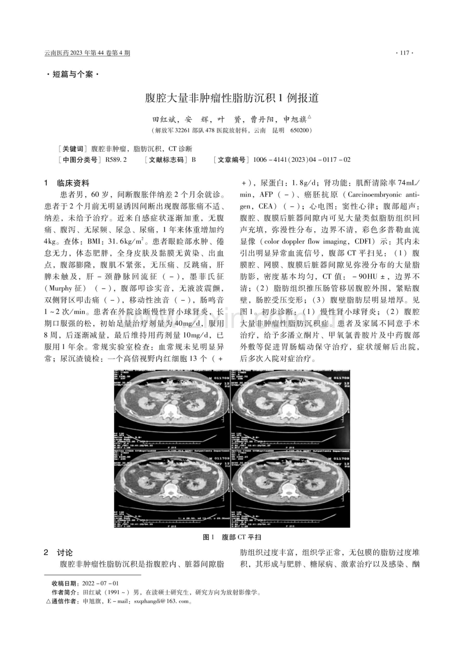 腹腔大量非肿瘤性脂肪沉积1例报道.pdf_第1页