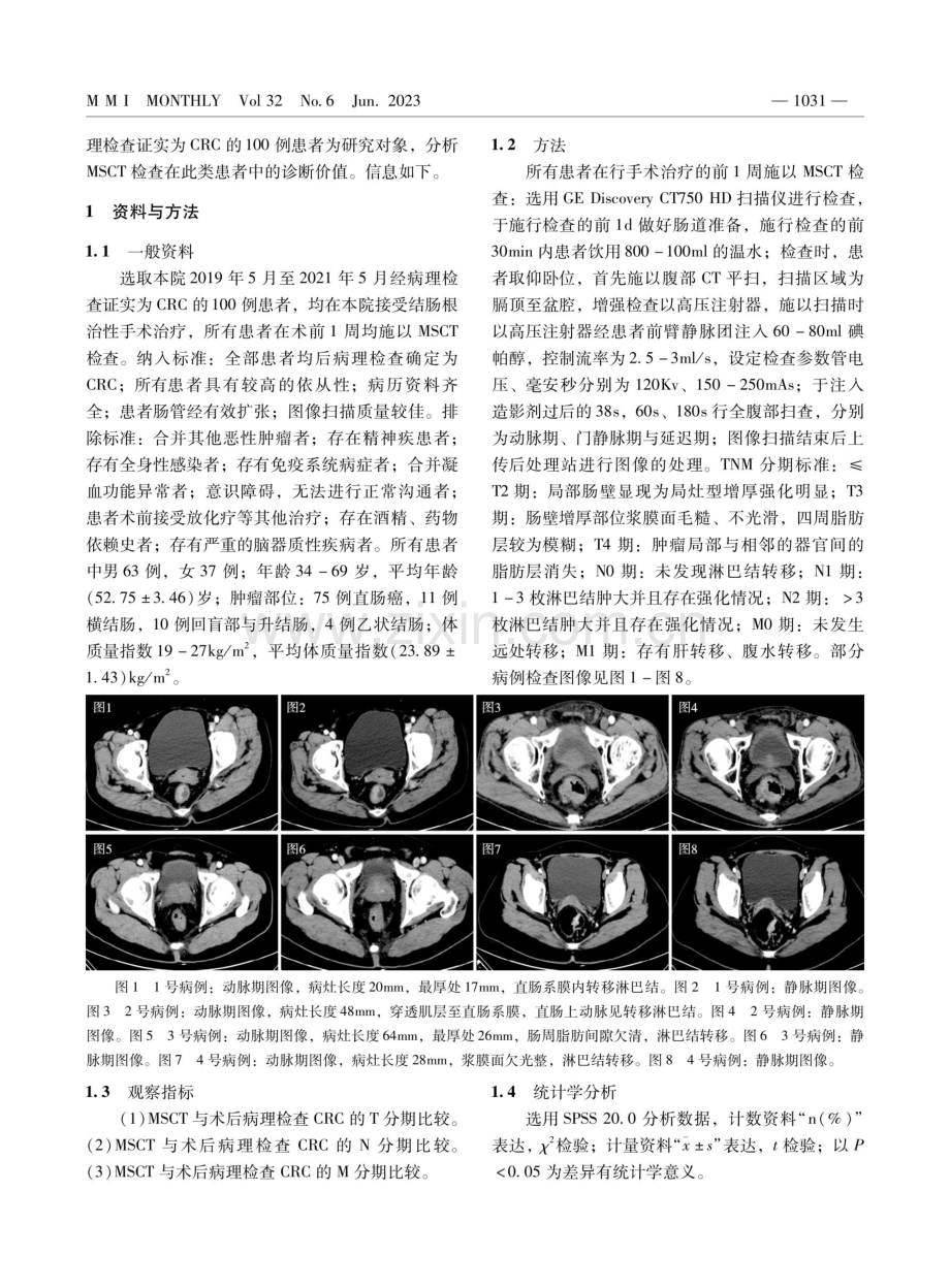 多层螺旋CT对结直肠癌术前TNM分期诊断的临床意义.pdf_第2页