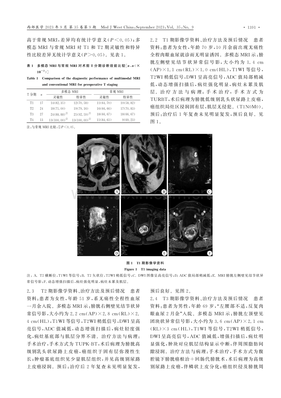 多模态MRI对膀胱尿路上皮癌临床分期及预后评估分析.pdf_第3页