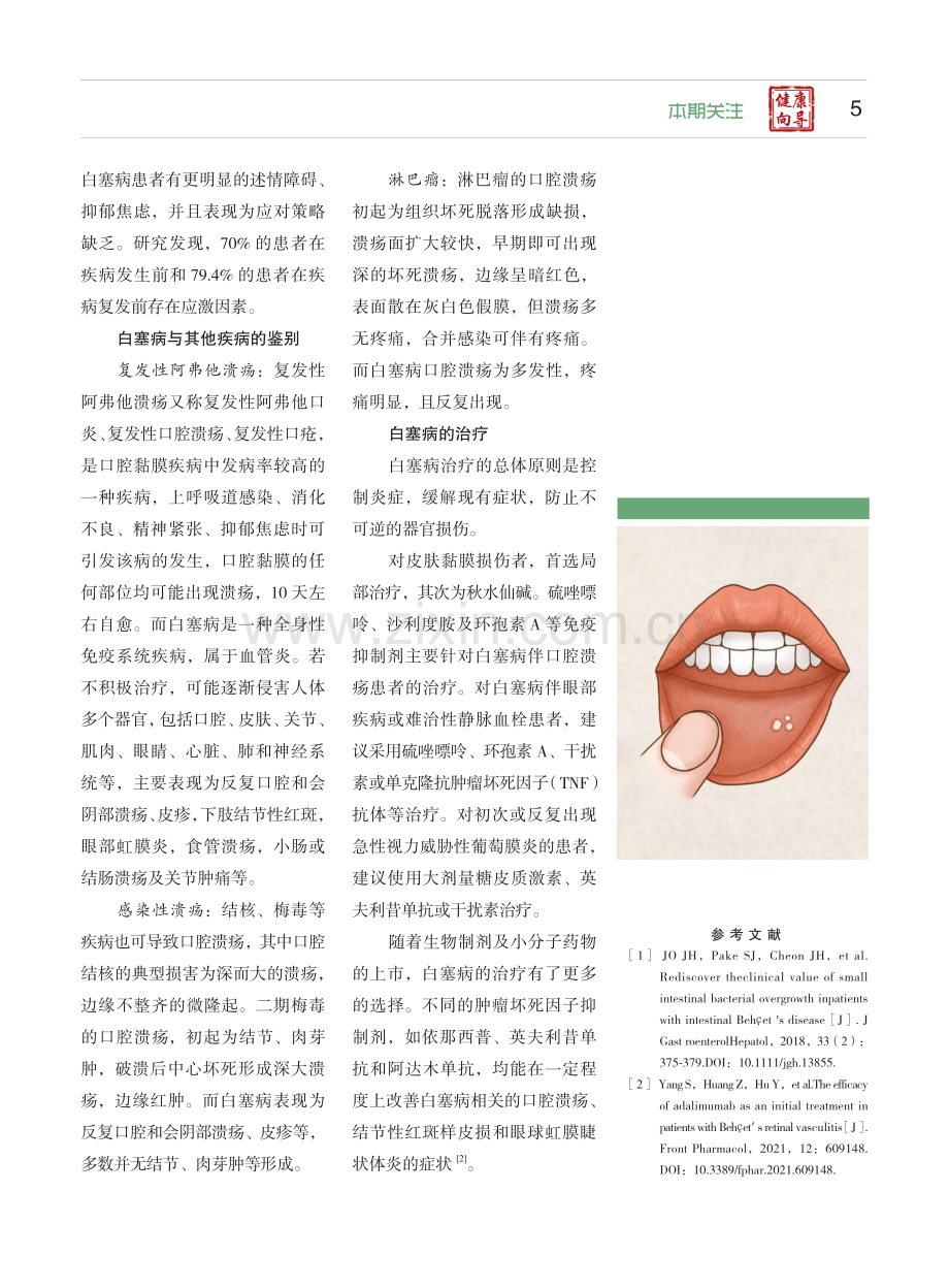 反复口腔溃疡 警惕白塞病.pdf_第2页