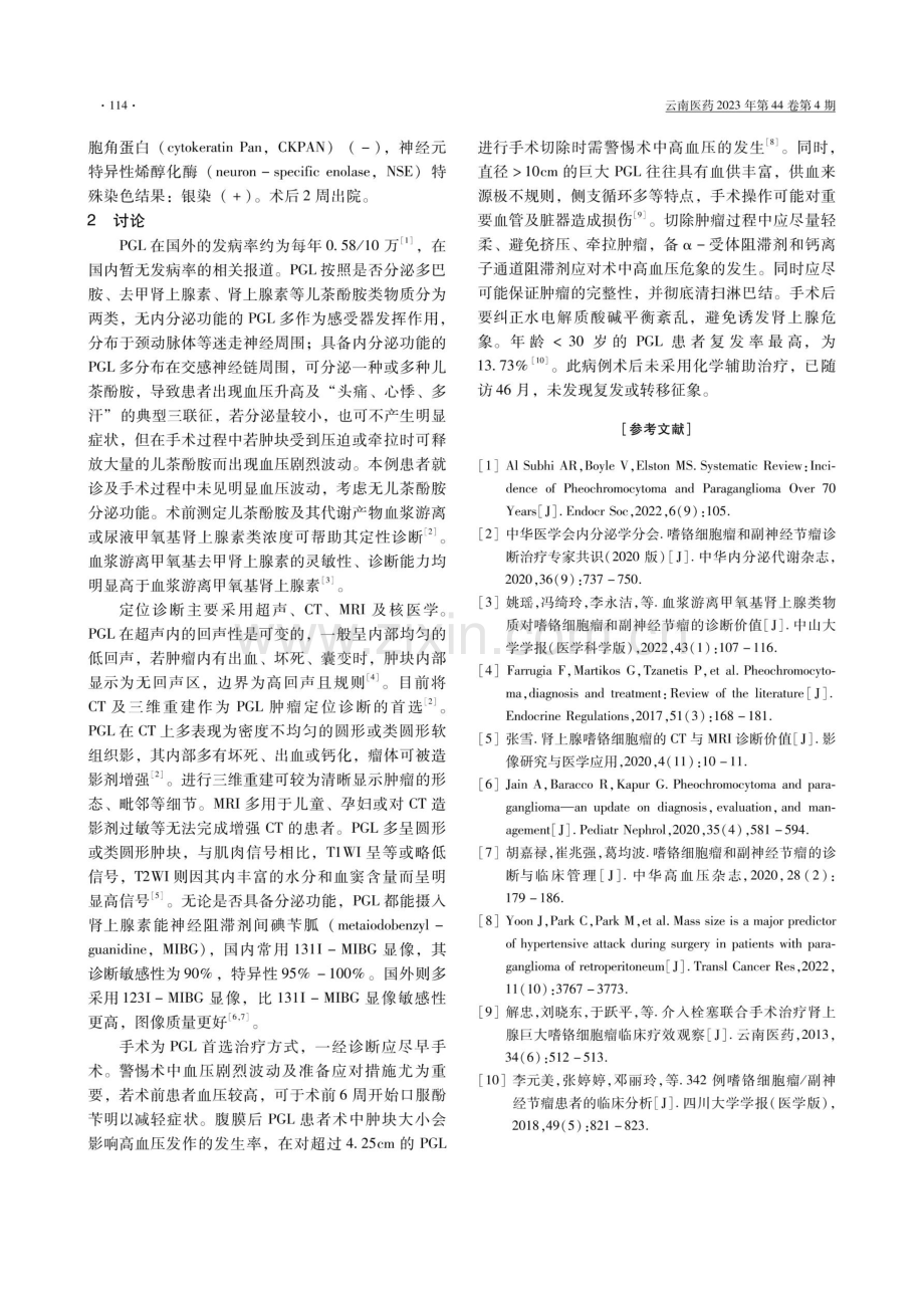 腹膜后巨大副神经节瘤1例并文献复习.pdf_第2页