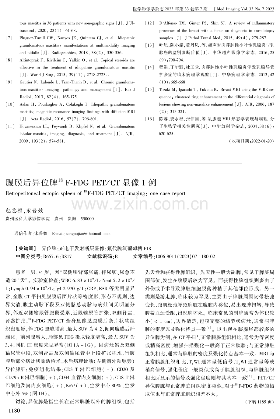 腹膜后异位脾18F-FDG PET_CT显像1例.pdf_第1页