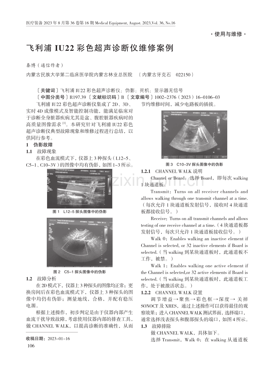 飞利浦IU22彩色超声诊断仪维修案例.pdf_第1页