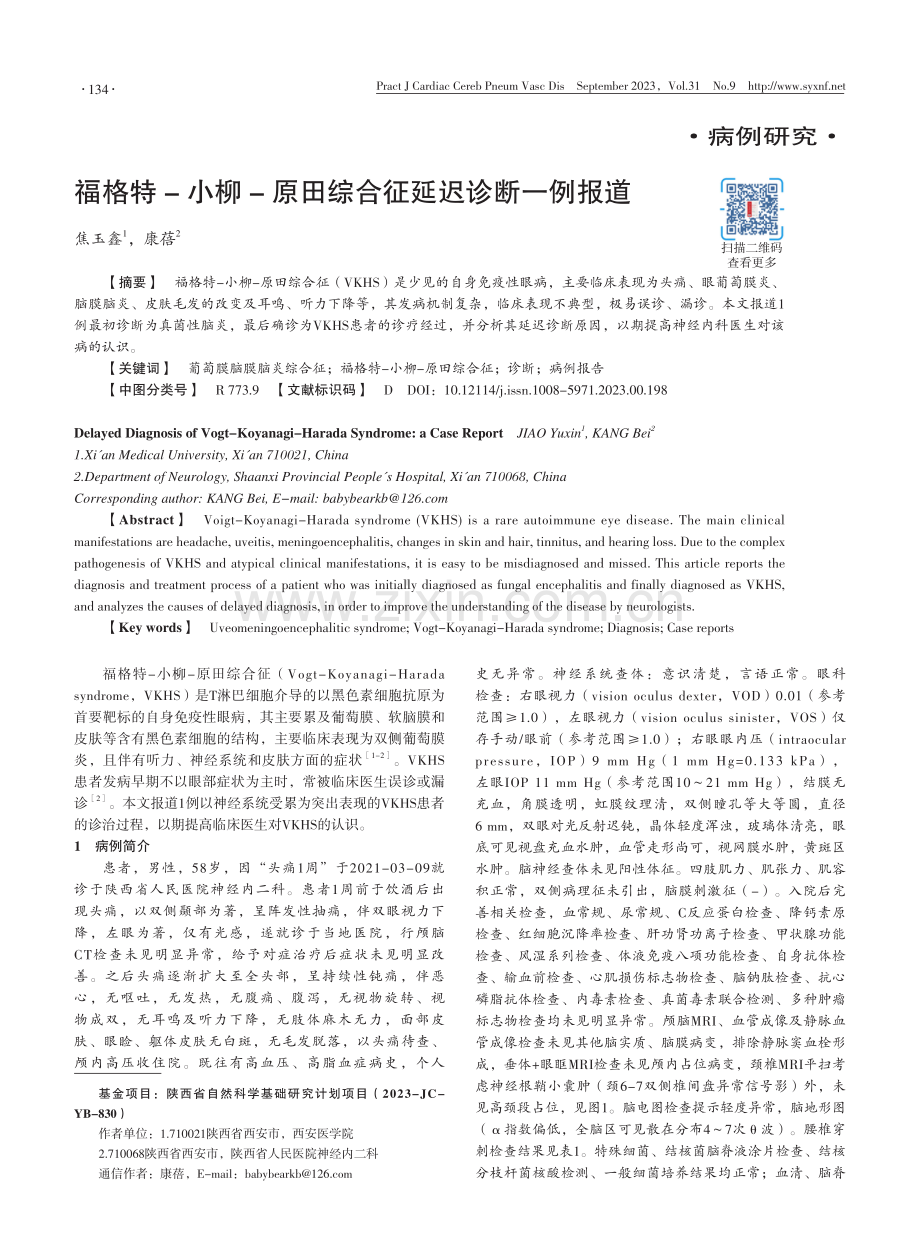 福格特-小柳-原田综合征延迟诊断一例报道.pdf_第1页