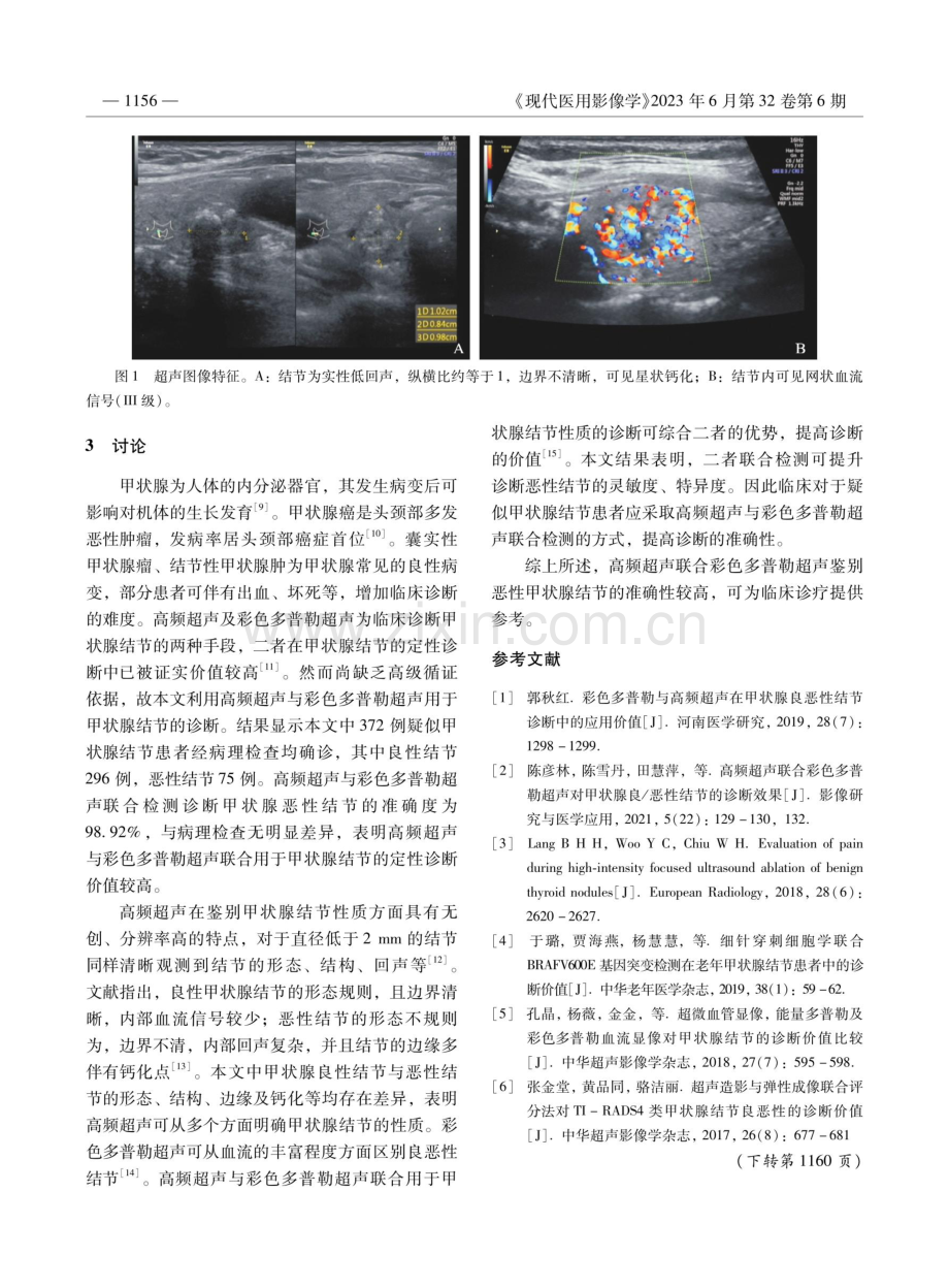 高频超声联合彩色多普勒超声诊断甲状腺恶性结节的价值.pdf_第3页