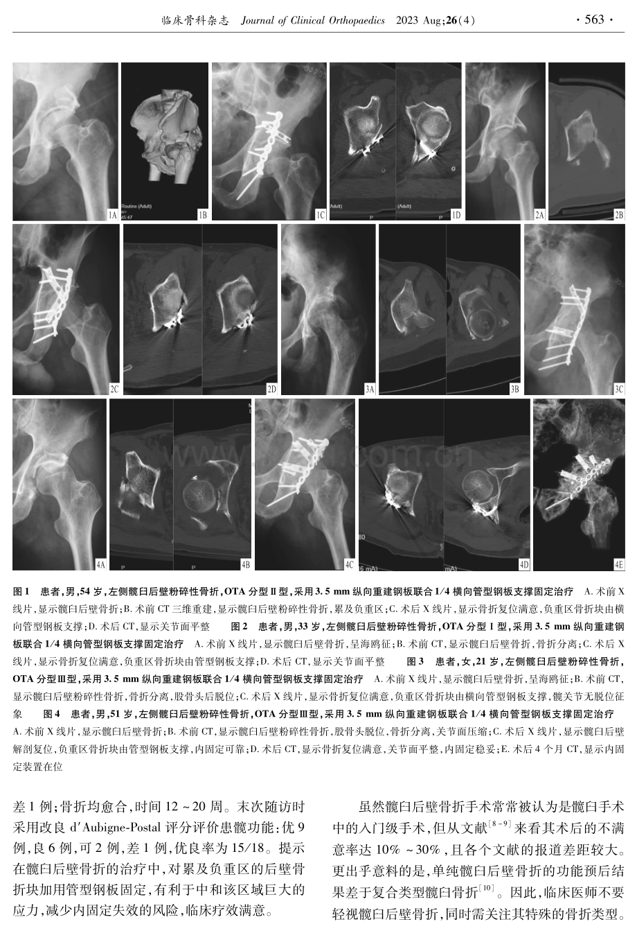 后壁负重区加用管型钢板治疗髋臼后壁骨折的疗效.pdf_第3页