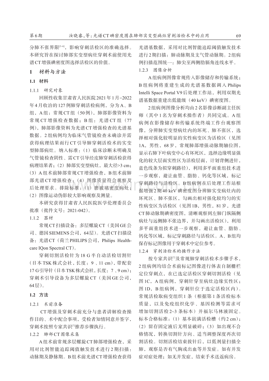 光谱CT碘密度图在肺部实变型病灶穿刺活检术中的应用.pdf_第2页